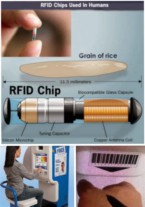 affordable care act rfid chips|are rfid implants mandatory.